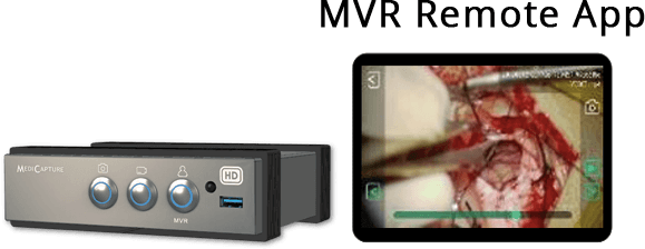 MVR and MVR Remote App