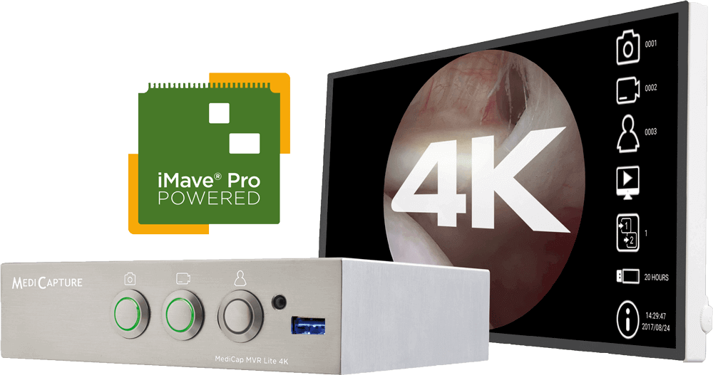 MVR Lite 4K plus Monitor
