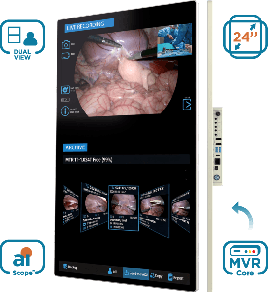 Products | Medical Imaging Equipment | MediCapture