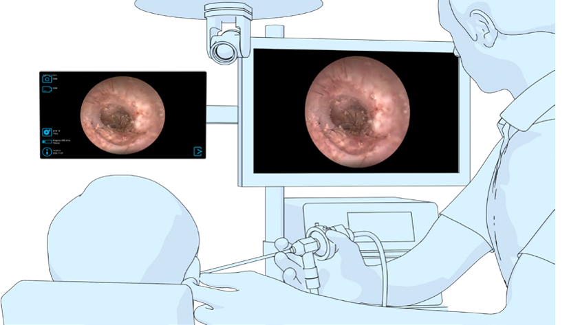 Illustration of MTR in use in Doctor’s Office Illustration of MTR in use in Doctor’s Office