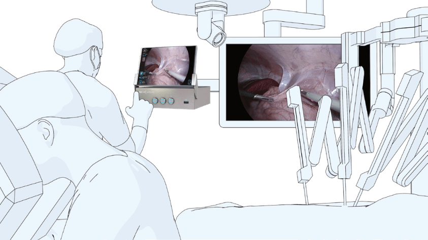 User Case - Robot-Assisted Surgical Units